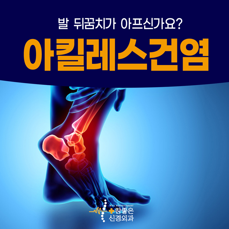 수영구 발목통증 발 뒤꿈치가 붓고 아프신가요? 아킬레스건염