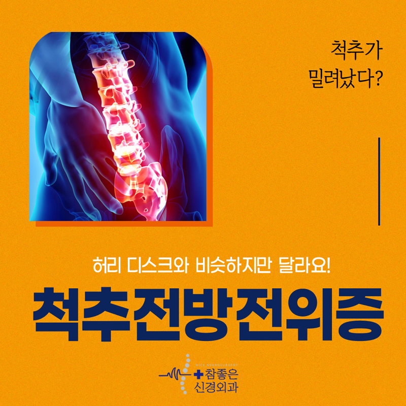 수영구 허리병원 디스크와는 다른 척추전방전위증