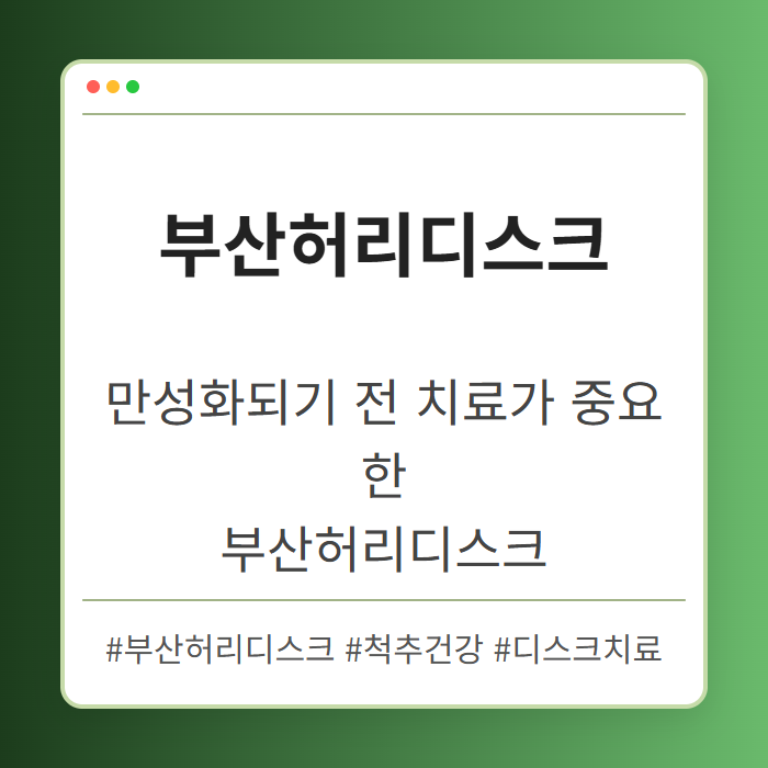 만성화되기 전 치료가 중요한 부산허리디스크