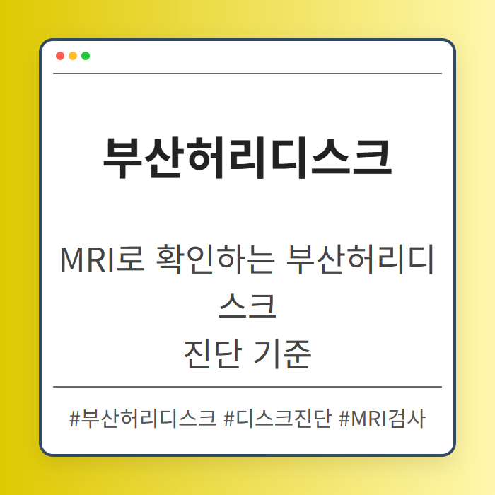 MRI로 확인하는 부산허리디스크 진단 기준